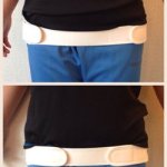 産後の骨盤矯正